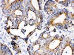 IDH2 Antibody in Immunohistochemistry (Paraffin) (IHC (P))