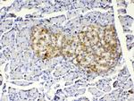 IGFBP-1 Antibody in Immunohistochemistry (Paraffin) (IHC (P))