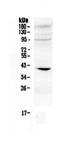 IGFBP3 Antibody in Western Blot (WB)