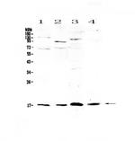 IL1F10 Antibody in Western Blot (WB)