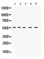 IRF5 Antibody in Western Blot (WB)