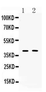 ISL1 Antibody in Western Blot (WB)