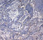 CD49e (Integrin alpha 5) Antibody in Immunohistochemistry (Paraffin) (IHC (P))