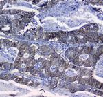 CD49e (Integrin alpha 5) Antibody in Immunohistochemistry (Paraffin) (IHC (P))