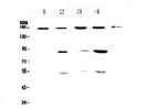 CD11b Antibody in Western Blot (WB)