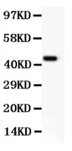 CD11b Antibody in Western Blot (WB)