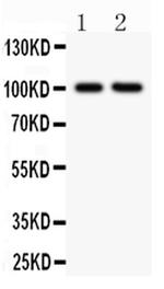 CD18 Antibody in Western Blot (WB)