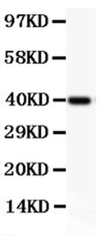 CD18 Antibody in Western Blot (WB)