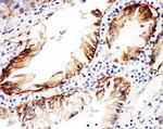 CD104 (Integrin beta 4) Antibody in Immunohistochemistry (Paraffin) (IHC (P))