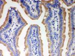 ITPR3 Antibody in Immunohistochemistry (Paraffin) (IHC (P))