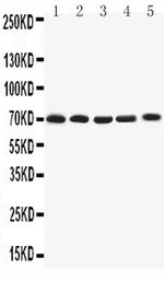 KV1.4 (KCNA4) Antibody in Western Blot (WB)