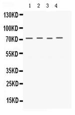 KV1.4 (KCNA4) Antibody in Western Blot (WB)