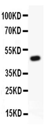 KV2.1 (KCNB1) Antibody in Western Blot (WB)