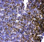 MCAK Antibody in Immunohistochemistry (Paraffin) (IHC (P))