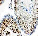 MCAK Antibody in Immunohistochemistry (Paraffin) (IHC (P))