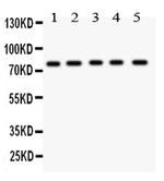 MCAK Antibody in Western Blot (WB)