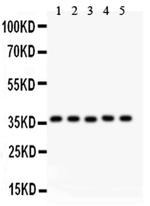 KLF6 Antibody in Western Blot (WB)