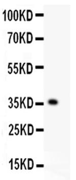 KLF6 Antibody in Western Blot (WB)