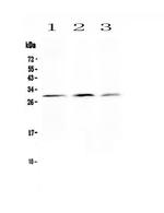 Kallikrein 2 Antibody in Western Blot (WB)