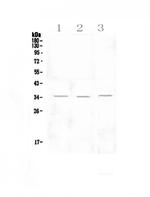 NKG2D (CD314) Antibody in Western Blot (WB)