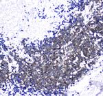 CD171 (L1CAM) Antibody in Immunohistochemistry (Paraffin) (IHC (P))