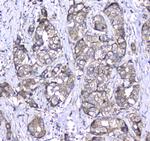 CD171 (L1CAM) Antibody in Immunohistochemistry (Paraffin) (IHC (P))