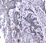 CD171 (L1CAM) Antibody in Immunohistochemistry (Paraffin) (IHC (P))