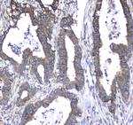 CD171 (L1CAM) Antibody in Immunohistochemistry (Paraffin) (IHC (P))