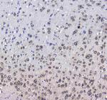 CD171 (L1CAM) Antibody in Immunohistochemistry (Paraffin) (IHC (P))