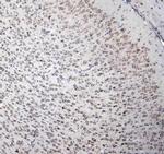 CD171 (L1CAM) Antibody in Immunohistochemistry (Paraffin) (IHC (P))