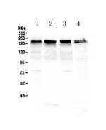 Laminin gamma-1,2,3 Antibody in Western Blot (WB)