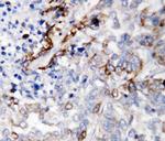 Laminin gamma-2 Antibody in Immunohistochemistry (Paraffin) (IHC (P))