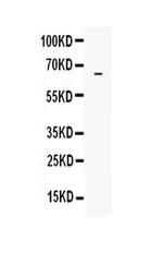 LBP Antibody in Western Blot (WB)