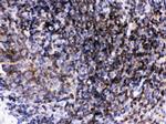 LCK Antibody in Immunohistochemistry (Paraffin) (IHC (P))