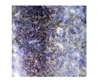 LCK Antibody in Immunohistochemistry (Frozen) (IHC (F))