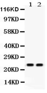 NGAL Antibody in Western Blot (WB)