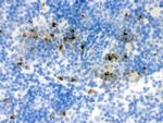 NGAL Antibody in Immunohistochemistry (Frozen) (IHC (F))