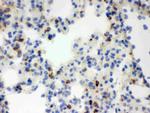 NGAL Antibody in Immunohistochemistry (Frozen) (IHC (F))