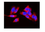 LDHA Antibody in Immunocytochemistry (ICC/IF)