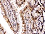 LDHA Antibody in Immunohistochemistry (Paraffin) (IHC (P))