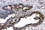 LDHA Antibody in Immunohistochemistry (Paraffin) (IHC (P))