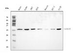 Galectin 3 Antibody in Western Blot (WB)