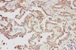 Galectin 3 Antibody in Immunohistochemistry (Paraffin) (IHC (P))