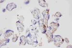 Galectin 3 Antibody in Immunohistochemistry (Paraffin) (IHC (P))