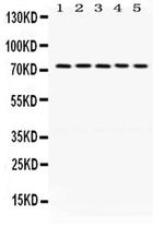 LIMK1 Antibody in Western Blot (WB)