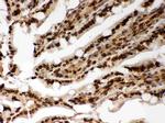 Lamin A/C Antibody in Immunohistochemistry (Paraffin) (IHC (P))