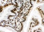 Lamin B1 Antibody in Immunohistochemistry (Paraffin) (IHC (P))