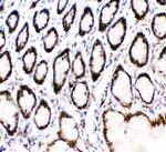 MAD1 Antibody in Immunohistochemistry (Paraffin) (IHC (P))