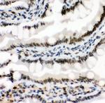 MAD1 Antibody in Immunohistochemistry (Paraffin) (IHC (P))