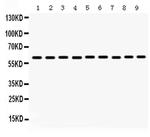 MAOB Antibody in Western Blot (WB)